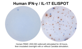 Human IFN-γ/IL-17 Double-Color ELISPOT | ImmunoSpot®