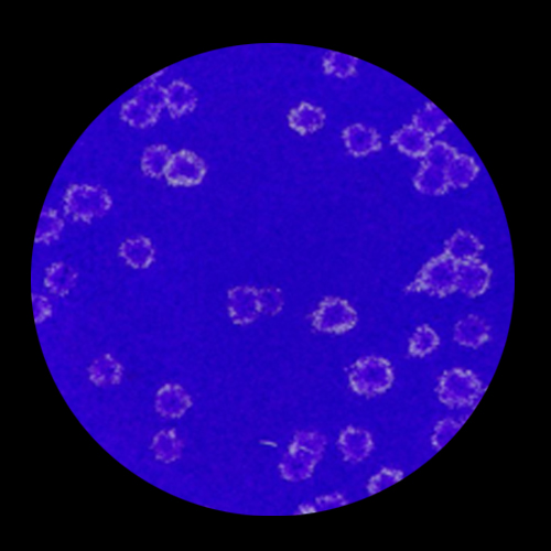 PRNT-SARS-CoV-2